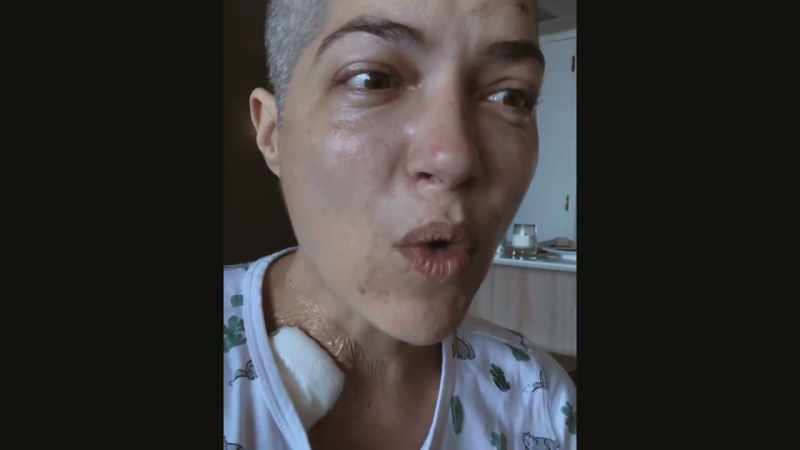 It was like paralyzed and I lost my vision, it went white