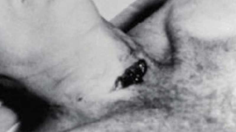 It looked like a gaping gash