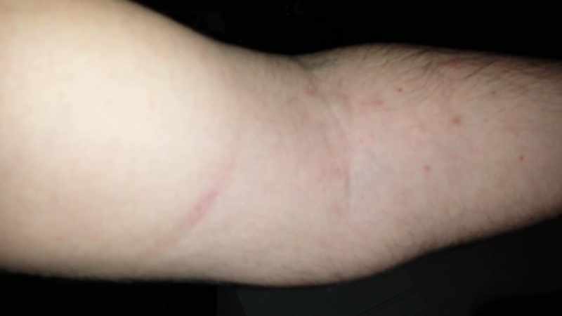 It looks like a burn or something
