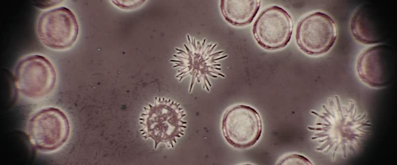 It looks like the alien cells are somehow