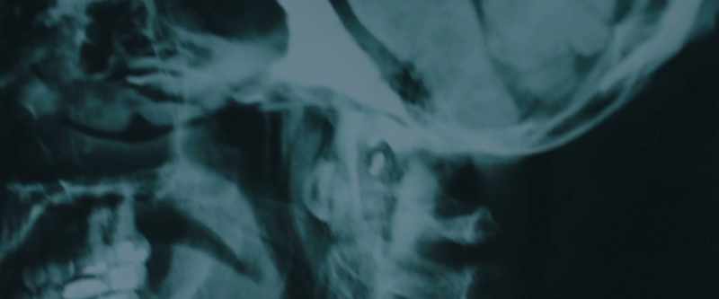 It was simply the wrong name on an X-ray