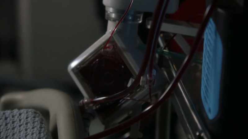 It takes his blood and puts extra oxygen in it