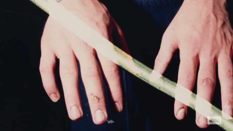 It was the fifth metacarpal