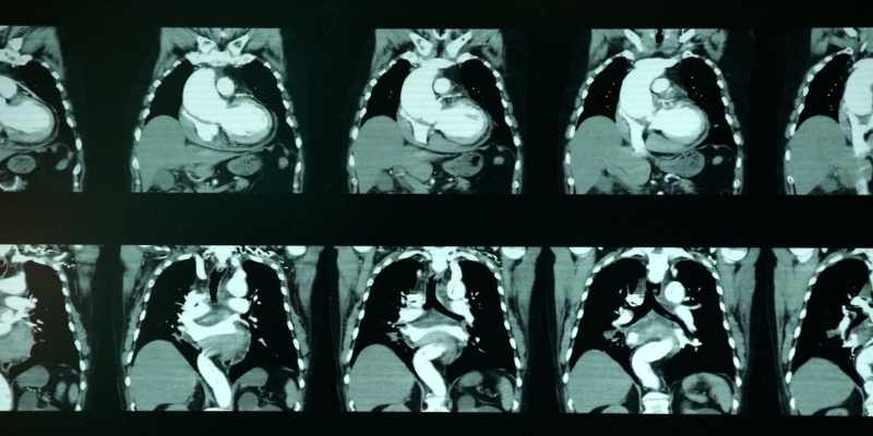 It wasn't the first miscarriage