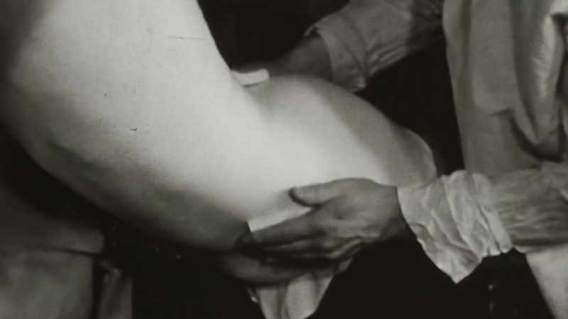 It will take a long time for the fracture in my pelvis to mend