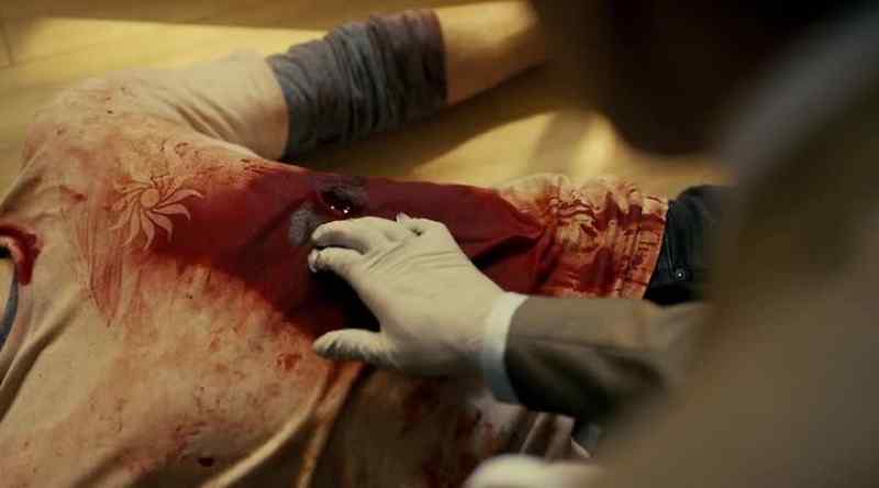 It's a knife wound