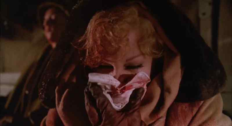 It's bad, isn't it? - They're gonna fix you right up