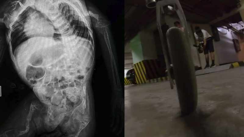 It's caused by a single mutation