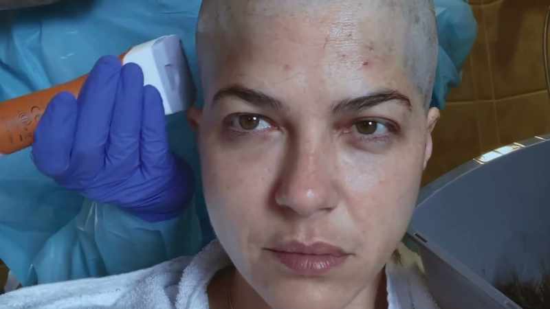 It's chemotherapy, it's Cyclophosphamide is the drug that we use