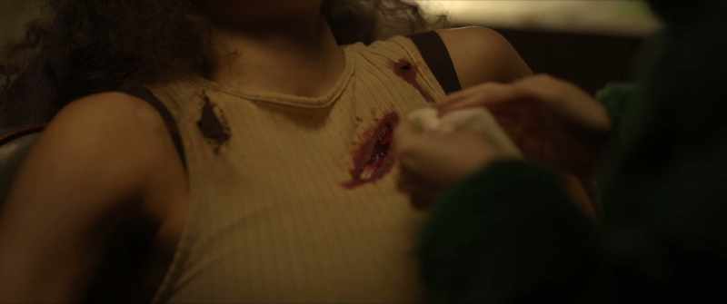 It's only a small stab wound to the chest