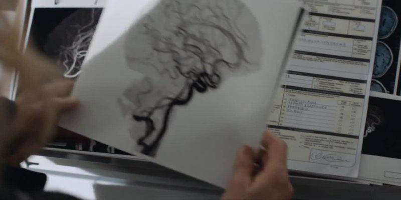 It's the disease that caused his stroke