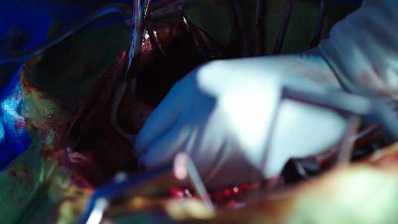 I've got control of the bleeding until we can repair it