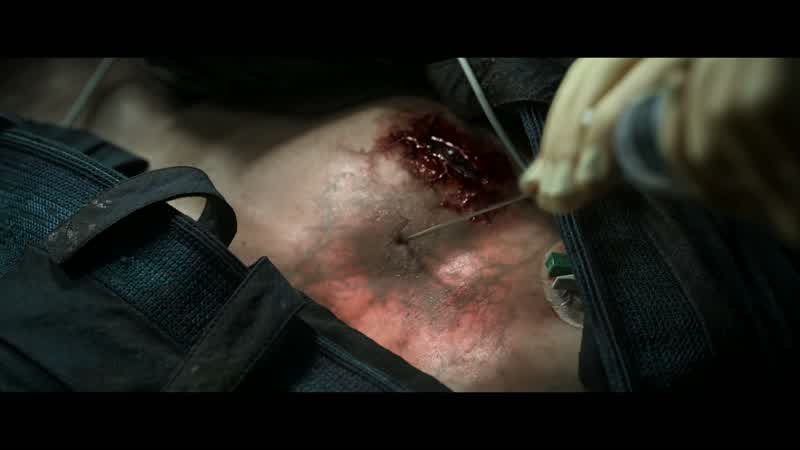 I've never seen a wound like this