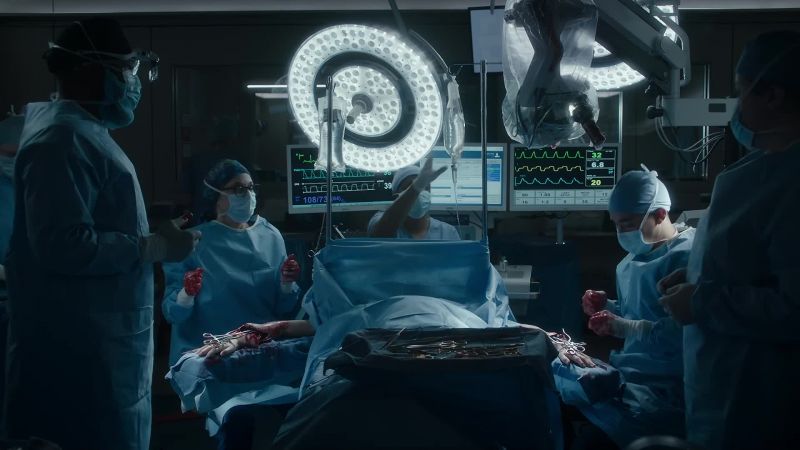JAKE: Both arterial anastomoses complete