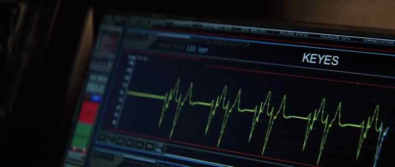 Josh's vital signs are dropping. - What?