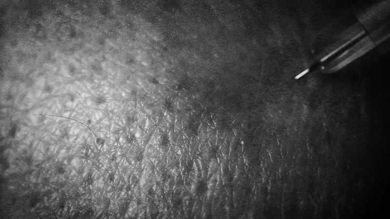 Just the prick of a needle