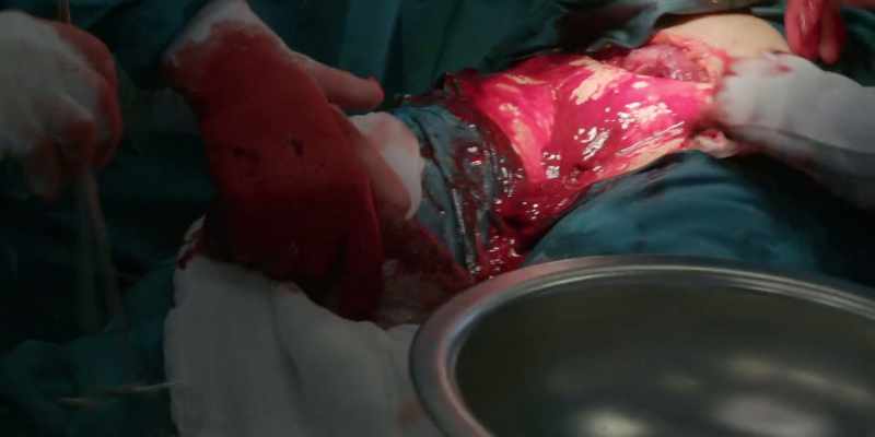 La placenta tiene una función fundamental