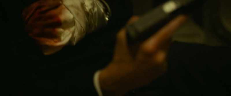 Let me see it. Put some pressure on it. - [Fitzroy mutters]
