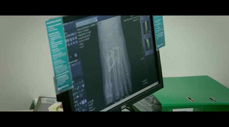 Let's have a look at your X-ray