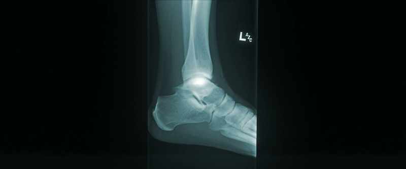 Let's see, left ankle, right hand, two elbows