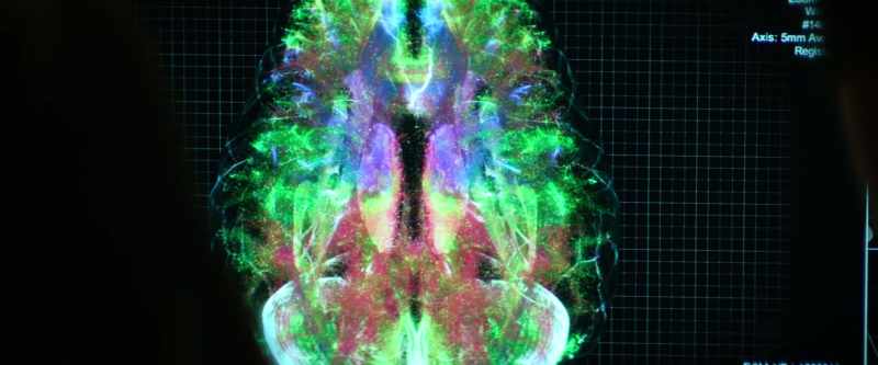 Like a bolt of lightning in your prefrontal cortex