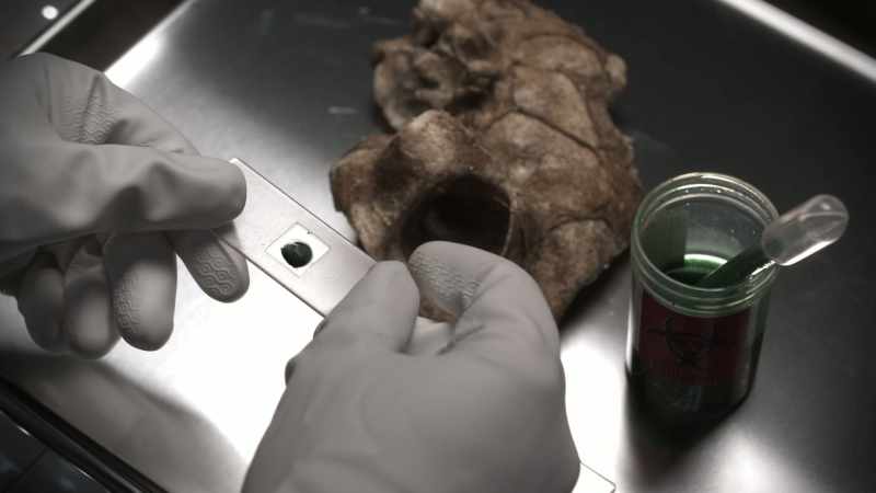 Log 55, to determine why some who are exposed to the prions turn