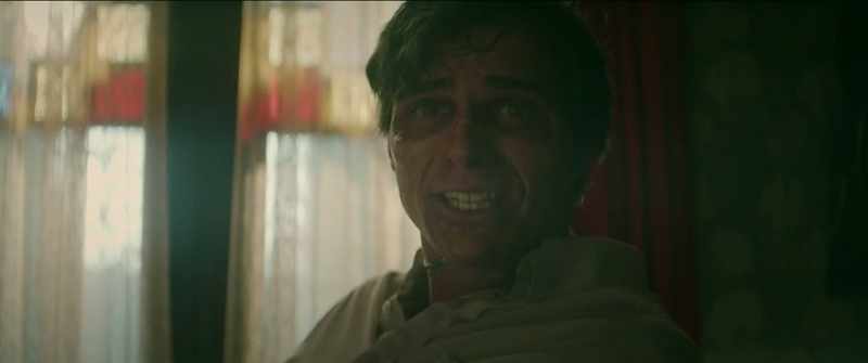 Look at me. I'm hideous
