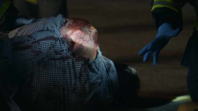 Looks like we got second-degree abrasions