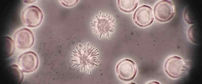 Looks like the alien cells are somehow