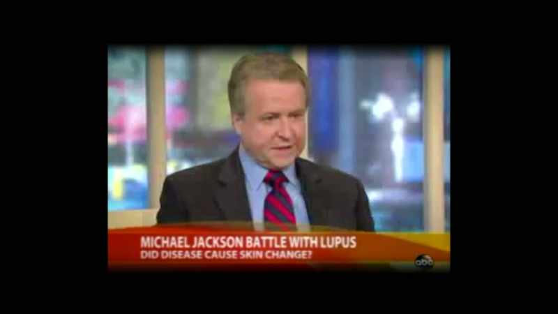 Lupus is an autoimmune disease, as you've said