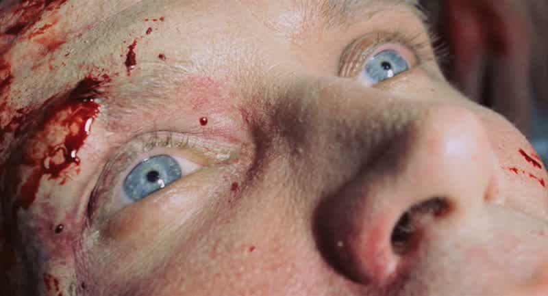 Man 2: Coarse v-fib
