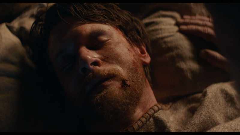 MAN: You lay there and rest