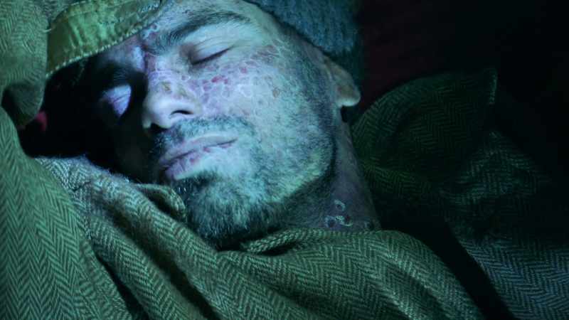 Mantle's disease. Shame they never found the cure