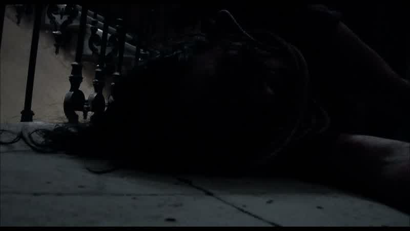 �Me ha mordido!