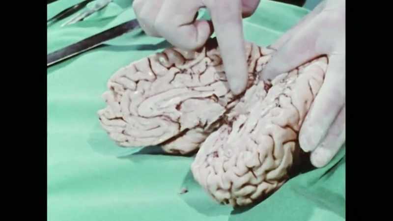 Michael Gazzaniga had said that the right hemisphere