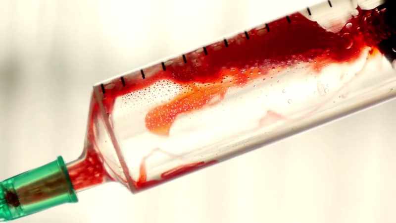 Milton's immunotherapy began