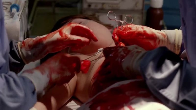 More gauze