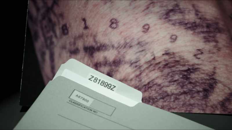 Mostly about arthritis and self-service machines