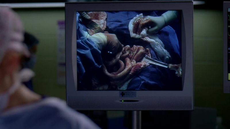 Mr. Aranda, let's get you up to bronchoscopy