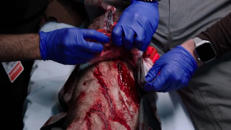 Mr. Mehti, your son's right. You're still bleeding