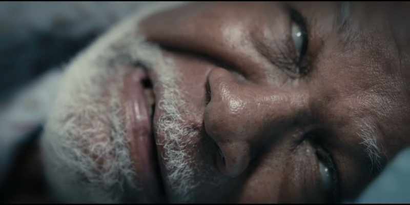 MR. PATEL: --Substantial bruising