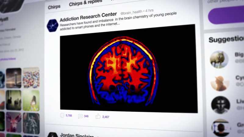 MRI scans, which really show the scan