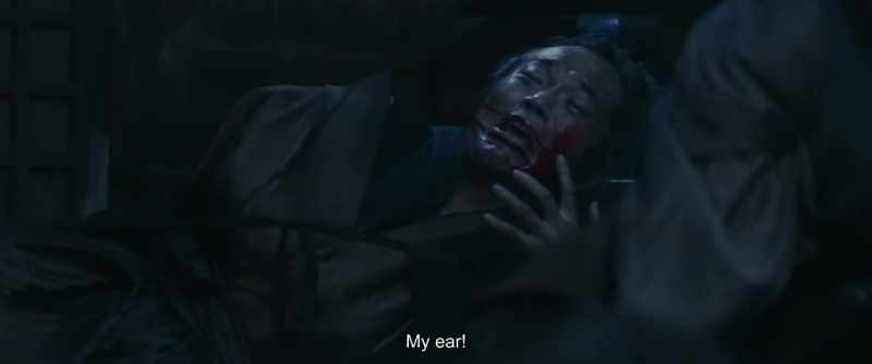My ear!