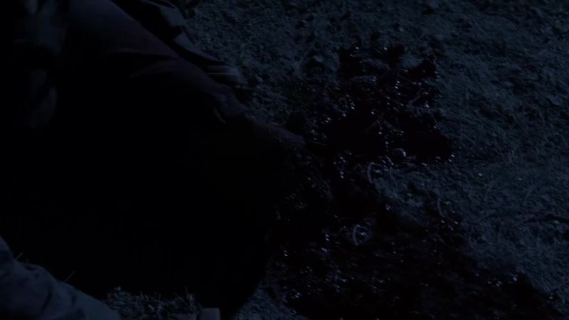 My leg