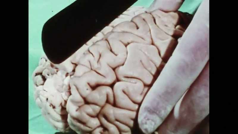 My training was that the left hemisphere
