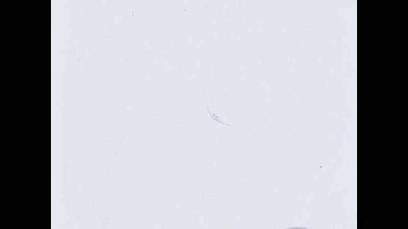 Narrator: Aldrin turns on his mounted camera