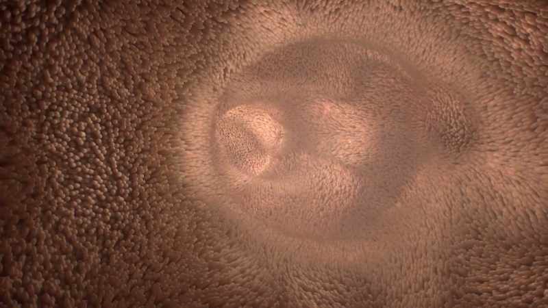 [narrator] But when these cells malfunction…