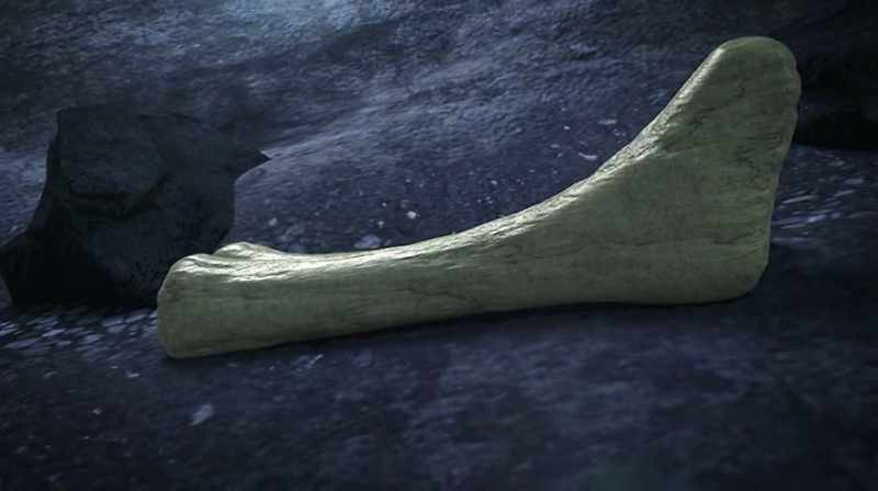 Narrator: EXPOSED BONES ARE AT RISK BECAUSE FRACTURES WILL FILL
