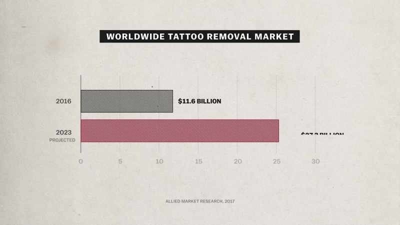 [narrator] Tattoo removal is now a multi-billion-dollar global industry