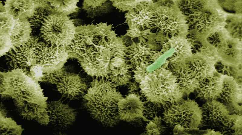 NARRATOR: The bacteria are about the same size